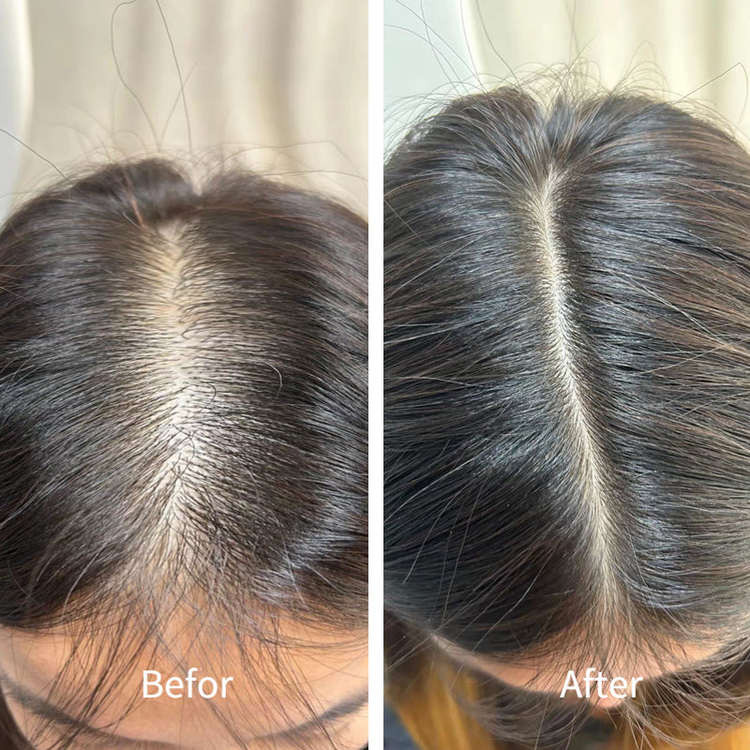 HREBLOOM 3 IN 1 SCALP MASSAGER FOR HAIR GROWTH